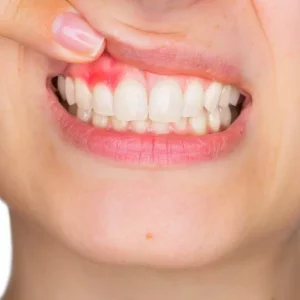 Periodontia: Cuidando da Saúde Buco-Dental com Profissionalismo e Dedicação