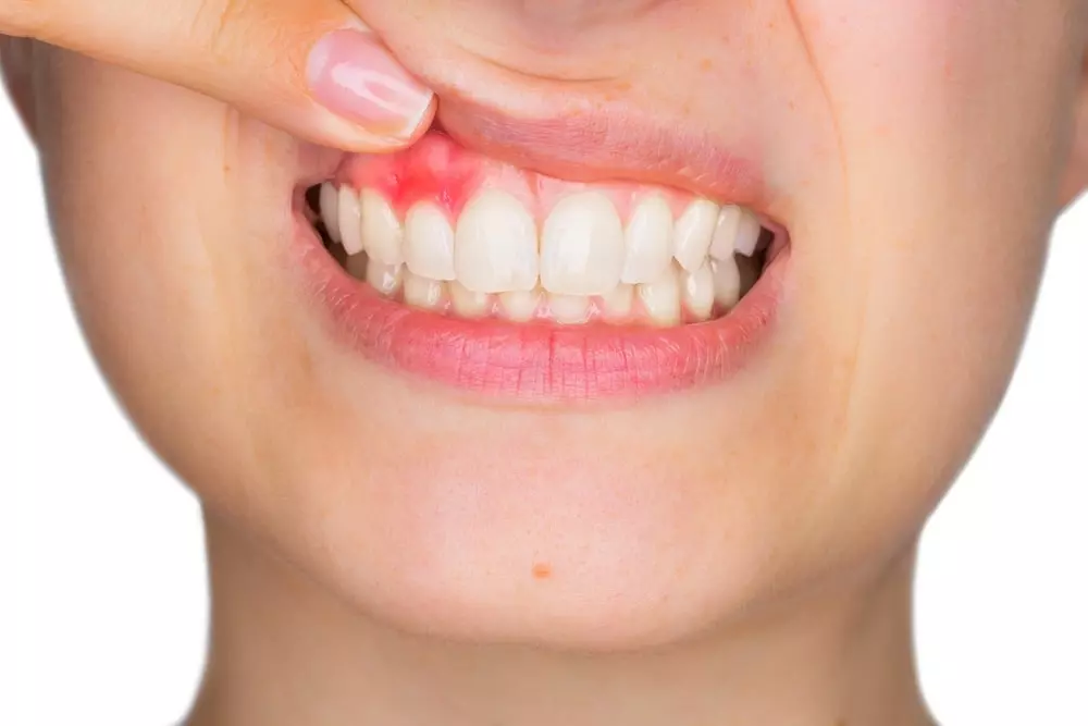 Periodontia: Cuidando da Saúde Buco-Dental com Profissionalismo e Dedicação